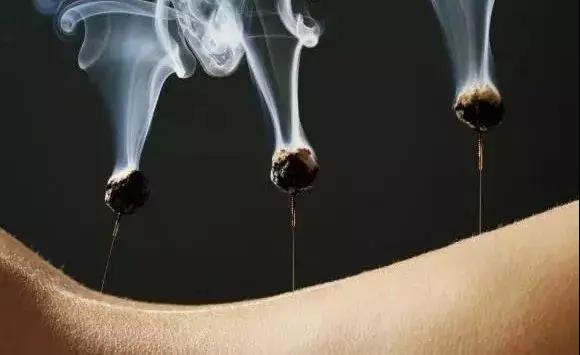 艾灸不是藥，調的不是病，央視為艾灸正名，讓我們正視艾灸